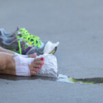 feet blister 2013 Dallas Fort Worth Susan G. Komen 3-Day breast cancer walk
